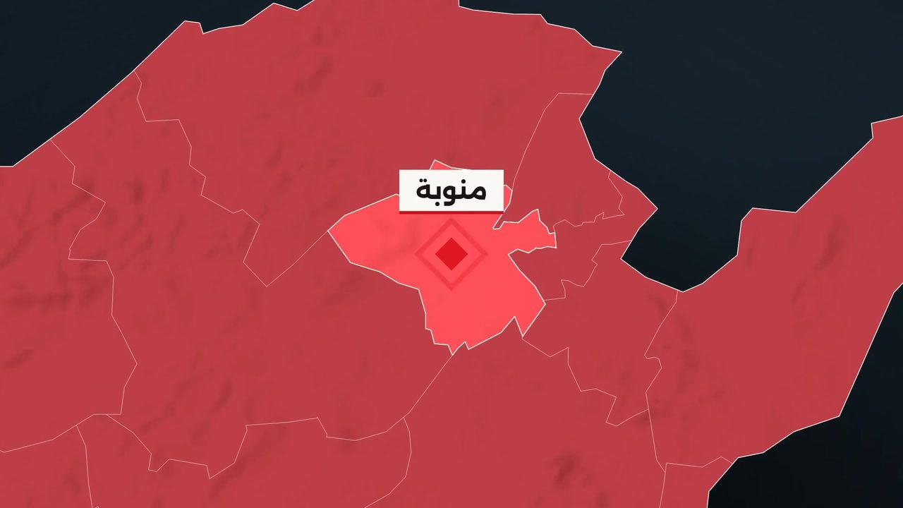 معهد القصاب يقدم فحوصات مجانية لهشاشة العظام